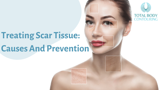 Treating Scar Tissue: Causes And Prevention