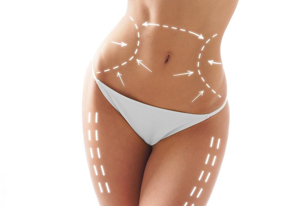 Ultraformer Contouring treatments Canberra