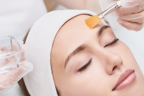 The Benefits of Chemical Peels for Glowing Skin